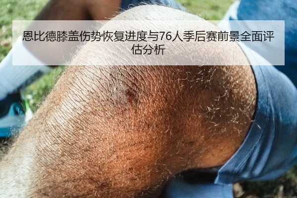 恩比德膝盖伤势恢复进度与76人季后赛前景全面评估分析